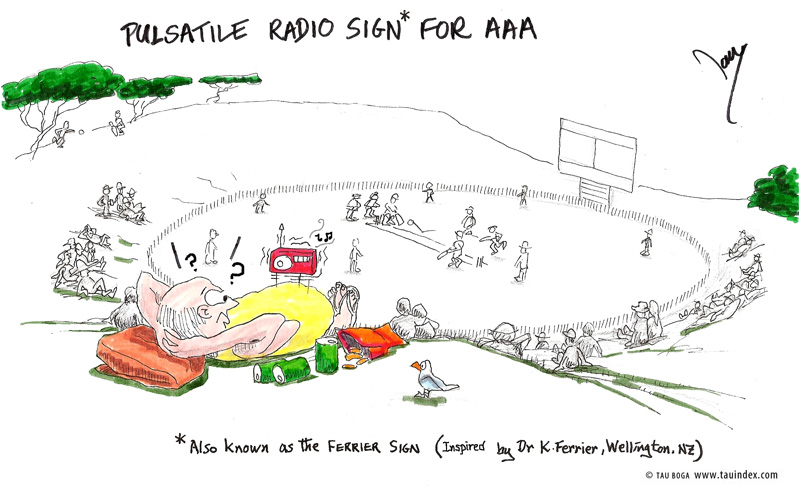 4-Pulsatile-radio-s#350005