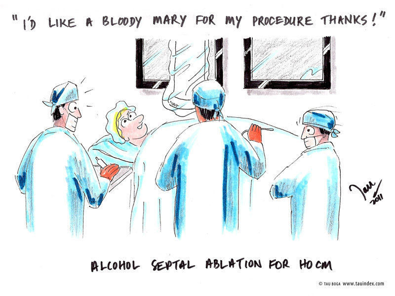 alcohol-ablation-tau-boga