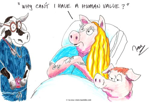 Human-valve-card-boga